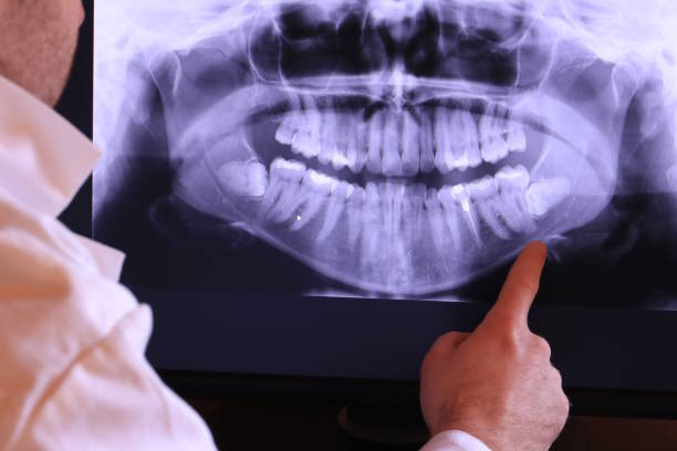 Best Emergency Treatment for Toothache in Hampton, GA